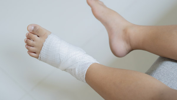 Dry Needling